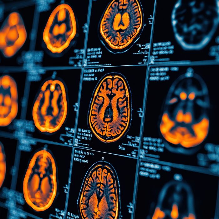 Colorful brain scans displayed on an array of medical imaging panels.