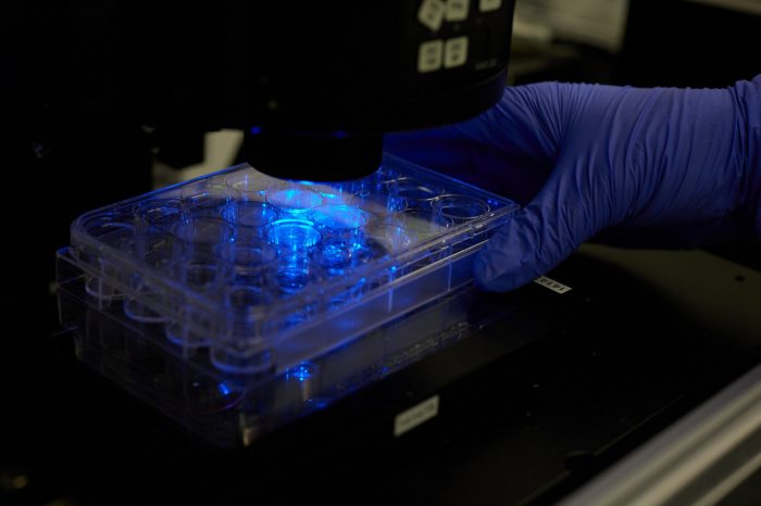 UNSW Biomedical engineering research