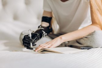 girl learning to write with a prosthetic arm. close eup cropped photo. writing process