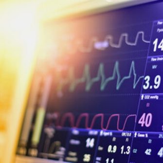 Carrive Group: Brain, Blood Pressure and Stress