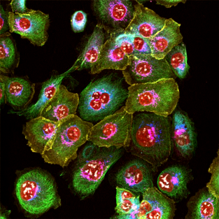 Lock Group: Cancer Systems Microscopy Lab
