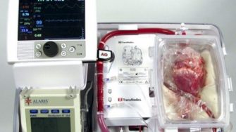 A heart in a box being kept alive by a machine