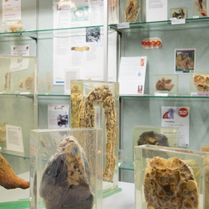 Specimens from the Museum of Human Disease