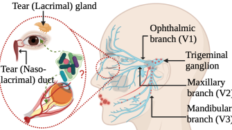 Microbial Pathogenesis in Alzheimers Disease