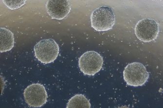 Stem cells confined in a circular shape on a soft gel display characteristics of embryonic development