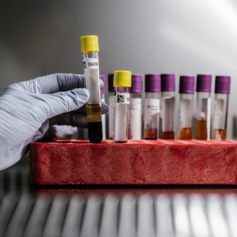 2024-12 Incidental photos of biospecimen samples in test tubes and slides