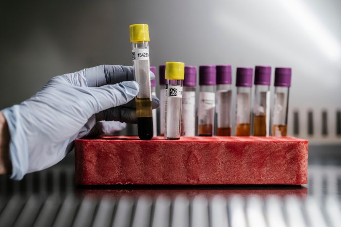 2024-12 Incidental photos of biospecimen samples in test tubes and slides