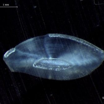 Microscopic scan from showing tiny organic material