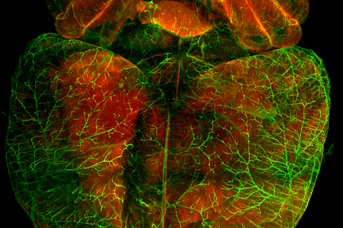 Lightsheet imaging technique by KGLMF