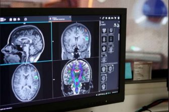 The National Imaging Facility