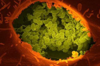 Medical Microbiology