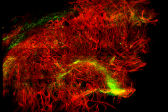 Travelling Through the Blood Vessel Network of a Tumour