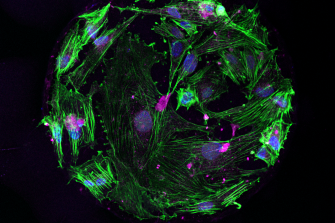 The Illuminators: Scope for Change 2025