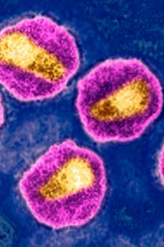 HIV virus. Image produced from an image taken with transmission electron microscopy. Viral diameter around 110 to 125 nm. (Photo by: BSIP/Universal Images Group via Getty Images)