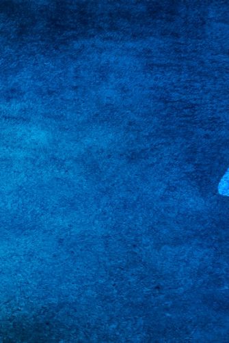 Diagnosis for dementia starts with a visit to a GP.